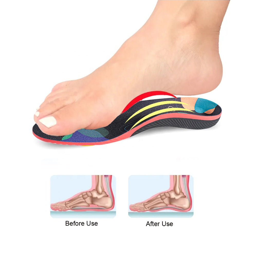 Arch-Support Insoles